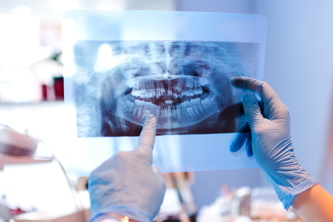 Next Generation Dental | Dental Fillings, Dental Sealants and Dental Cleanings
