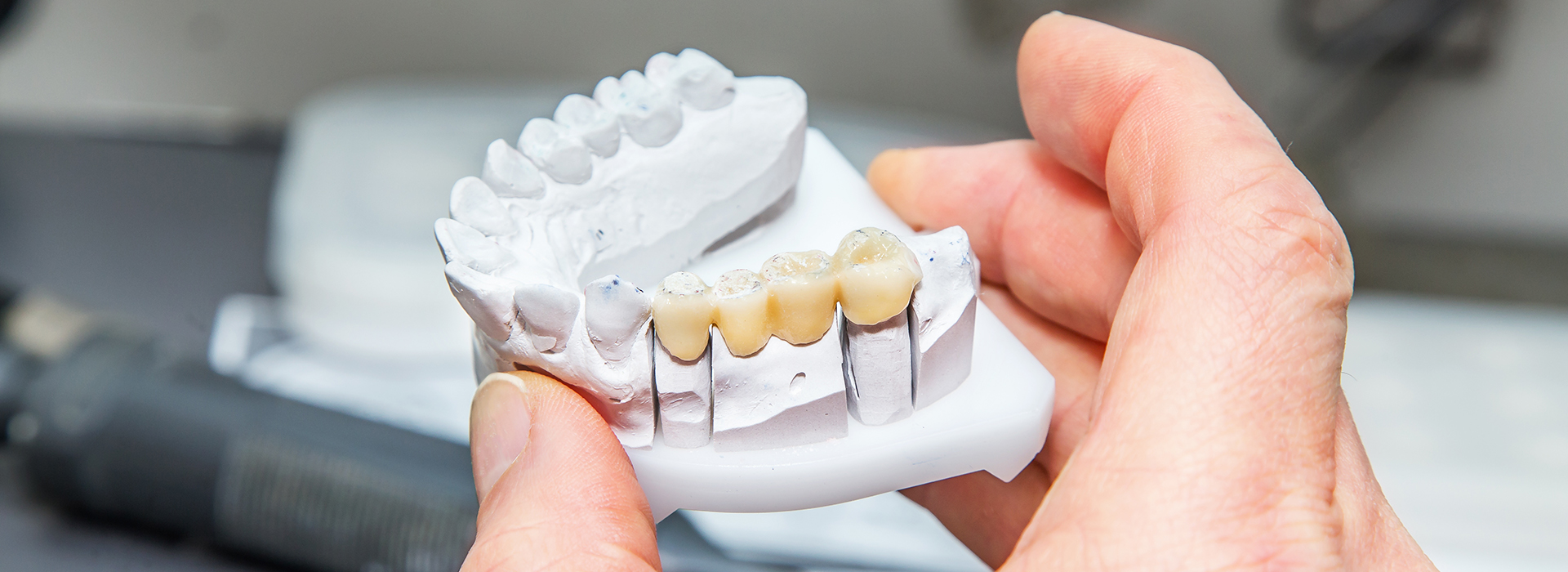 Next Generation Dental | Implant Dentistry, Preventative Program and Dental Fillings