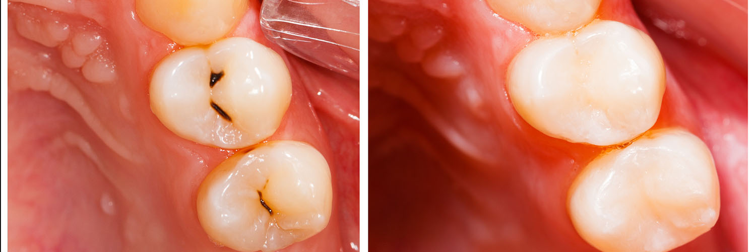 Next Generation Dental